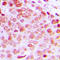DEAD-Box Helicase 5 antibody, LS-C358965, Lifespan Biosciences, Immunohistochemistry paraffin image 
