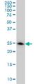 L-xylulose reductase antibody, H00051181-M03, Novus Biologicals, Western Blot image 