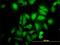 ABL Proto-Oncogene 2, Non-Receptor Tyrosine Kinase antibody, H00000027-M09, Novus Biologicals, Immunofluorescence image 