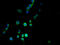 Mannosidase Beta Like antibody, A59750-100, Epigentek, Immunofluorescence image 