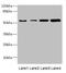 Cholinergic Receptor Nicotinic Epsilon Subunit antibody, LS-C675535, Lifespan Biosciences, Western Blot image 