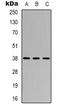 Cysteinyl Leukotriene Receptor 1 antibody, LS-C368973, Lifespan Biosciences, Western Blot image 