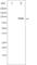 Signal Transducer And Activator Of Transcription 5B antibody, abx011812, Abbexa, Western Blot image 