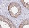 alpha-Tubulin antibody, NBP2-54708, Novus Biologicals, Immunohistochemistry paraffin image 