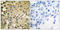 SMAD Family Member 3 antibody, LS-C199588, Lifespan Biosciences, Immunohistochemistry paraffin image 