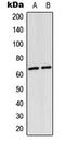 p65 antibody, LS-C354091, Lifespan Biosciences, Western Blot image 