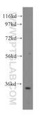 60S ribosomal protein L6 antibody, 15387-1-AP, Proteintech Group, Western Blot image 