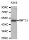 Keratin 31 antibody, STJ24358, St John