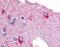 Glycogen Phosphorylase B antibody, MBS395591, MyBioSource, Immunohistochemistry paraffin image 