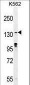 Ovostatin homolog 2 antibody, LS-C163300, Lifespan Biosciences, Western Blot image 