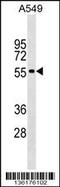 Gliomedin antibody, 59-280, ProSci, Western Blot image 