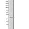 Aquaporin 9 antibody, abx148282, Abbexa, Western Blot image 