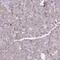 Prolyl Endopeptidase antibody, NBP2-33950, Novus Biologicals, Immunohistochemistry paraffin image 
