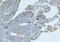 Keratin 5 antibody, M00398-7, Boster Biological Technology, Immunohistochemistry paraffin image 