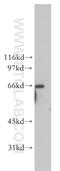 Ribophorin I antibody, 12894-1-AP, Proteintech Group, Western Blot image 