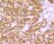 SLC9A3 Regulator 1 antibody, A02427, Boster Biological Technology, Immunohistochemistry frozen image 