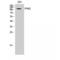 Protein Tyrosine Kinase 2 Beta antibody, LS-C385695, Lifespan Biosciences, Western Blot image 