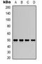 Potassium Calcium-Activated Channel Subfamily N Member 4 antibody, orb334754, Biorbyt, Western Blot image 