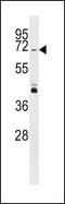 Serine/threonine-protein kinase PINK1, mitochondrial antibody, PA5-13402, Invitrogen Antibodies, Western Blot image 