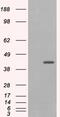 GIPC PDZ Domain Containing Family Member 1 antibody, 45-064, ProSci, Western Blot image 