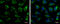 Ribonucleotide Reductase Regulatory Subunit M2 antibody, GTX103193, GeneTex, Immunofluorescence image 