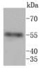 Matrix Metallopeptidase 11 antibody, A04490, Boster Biological Technology, Western Blot image 