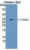 Angiopoietin Like 5 antibody, LS-C375009, Lifespan Biosciences, Western Blot image 