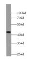 TDP43 antibody, FNab08574, FineTest, Western Blot image 