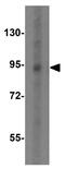 Toll Like Receptor 3 antibody, GTX31291, GeneTex, Western Blot image 