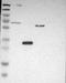 Poly(ADP-Ribose) Polymerase Family Member 14 antibody, NBP1-93593, Novus Biologicals, Western Blot image 