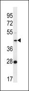 OTU Deubiquitinase With Linear Linkage Specificity Like antibody, 56-548, ProSci, Western Blot image 