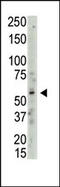 Protein Arginine Methyltransferase 3 antibody, 55-024, ProSci, Western Blot image 