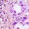 Thyroid Hormone Receptor Interactor 13 antibody, orb214887, Biorbyt, Immunohistochemistry paraffin image 