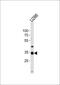 NK3 Homeobox 2 antibody, PA5-35191, Invitrogen Antibodies, Western Blot image 