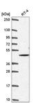 AKT Serine/Threonine Kinase 2 antibody, NBP2-55812, Novus Biologicals, Western Blot image 