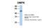 DM1 Protein Kinase antibody, PA5-42121, Invitrogen Antibodies, Western Blot image 