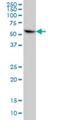 Cytochrome B5 Reductase 4 antibody, H00051167-M01, Novus Biologicals, Western Blot image 