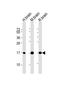 Microtubule Associated Protein 1 Light Chain 3 Alpha antibody, GTX17380, GeneTex, Western Blot image 