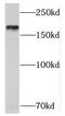 Tensin-1 antibody, FNab08846, FineTest, Western Blot image 