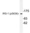 Insulin Receptor Substrate 1 antibody, LS-C178019, Lifespan Biosciences, Western Blot image 