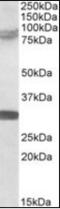 Tripartite Motif Containing 2 antibody, orb94244, Biorbyt, Western Blot image 