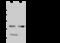 Lymphotoxin Beta Receptor antibody, GTX02494, GeneTex, Western Blot image 