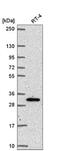 Nuclear Receptor Interacting Protein 3 antibody, NBP2-58112, Novus Biologicals, Western Blot image 