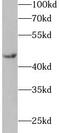 Interleukin 11 Receptor Subunit Alpha antibody, FNab04217, FineTest, Western Blot image 