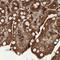 Eukaryotic Translation Initiation Factor 2B Subunit Gamma antibody, HPA024219, Atlas Antibodies, Immunohistochemistry paraffin image 