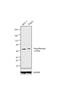 Neurofibromin 1 antibody, GTX15776, GeneTex, Western Blot image 