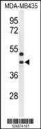G Protein-Coupled Receptor 17 antibody, 64-147, ProSci, Western Blot image 