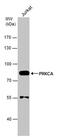 Protein Kinase C Alpha antibody, PA5-22160, Invitrogen Antibodies, Western Blot image 