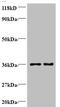 Phosphatidylserine Synthase 1 antibody, A51789-100, Epigentek, Western Blot image 
