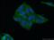Nicotinamide N-Methyltransferase antibody, 15123-1-AP, Proteintech Group, Immunofluorescence image 